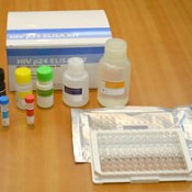 Ryukyu Immunology Corporation develops test kits to detect HIV infection