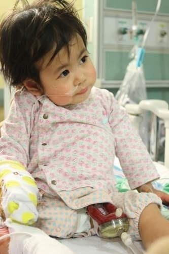 Heart transplant operation of one-year-old Onaga is successful